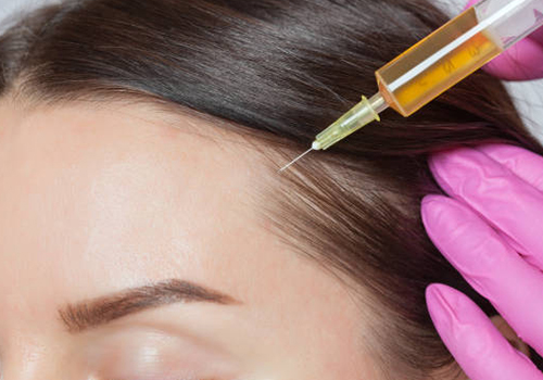 What Causes Hair Loss?