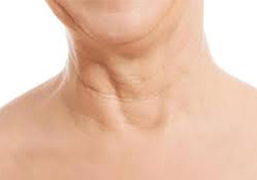 What You Need To Know About Chin Fillers