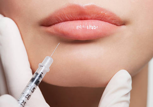 How Long Will Lip Fillers Last?