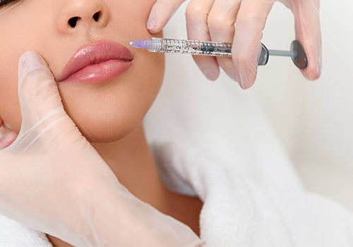 Dermal Filler Helps Reduce Smile Lines